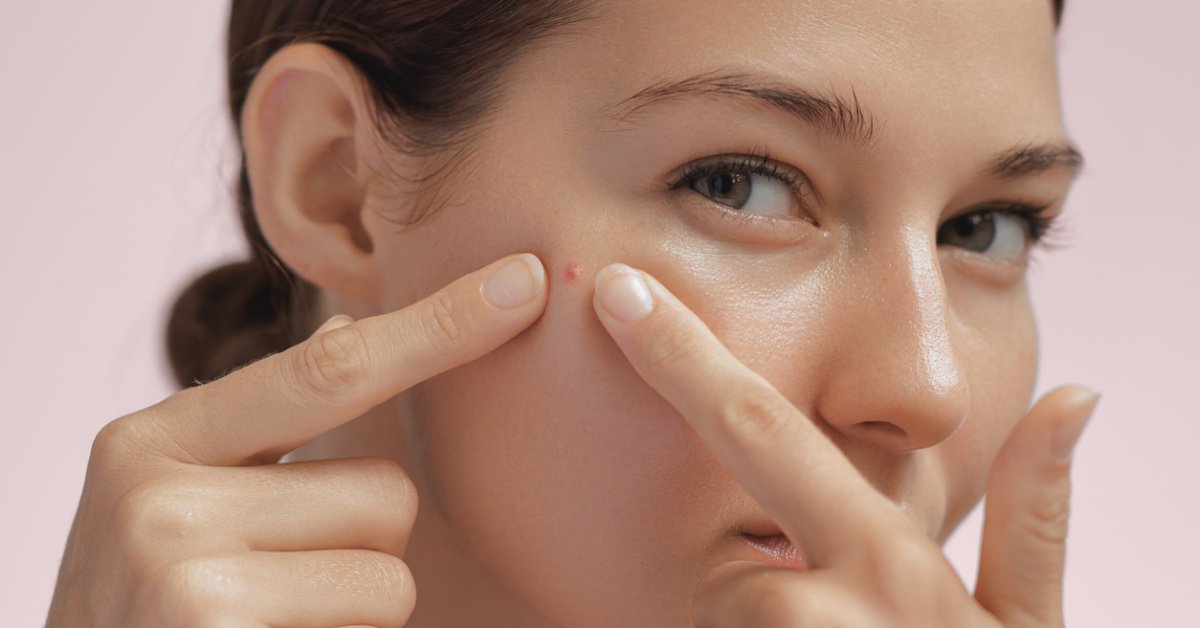 Sivilce sıkmak orucu bozar mı? Diyanet’e göre oruçluyken sivilce sıkma orucu bozar mı?