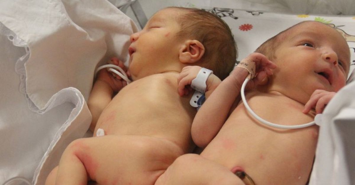 Son dakika: Depremle birlikte öksüz ve yetim kalan siyam ikizi kardeşleri 9 yaşında ölüm ayırdı