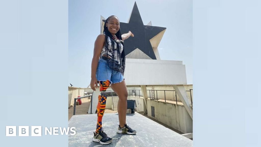 ‘My prosthetic leg represents my love for this country Ghana’
