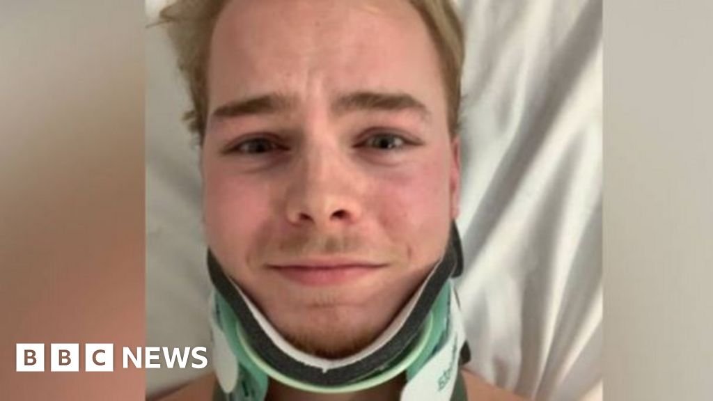 I was in a car crash – then I forgot how to speak Welsh